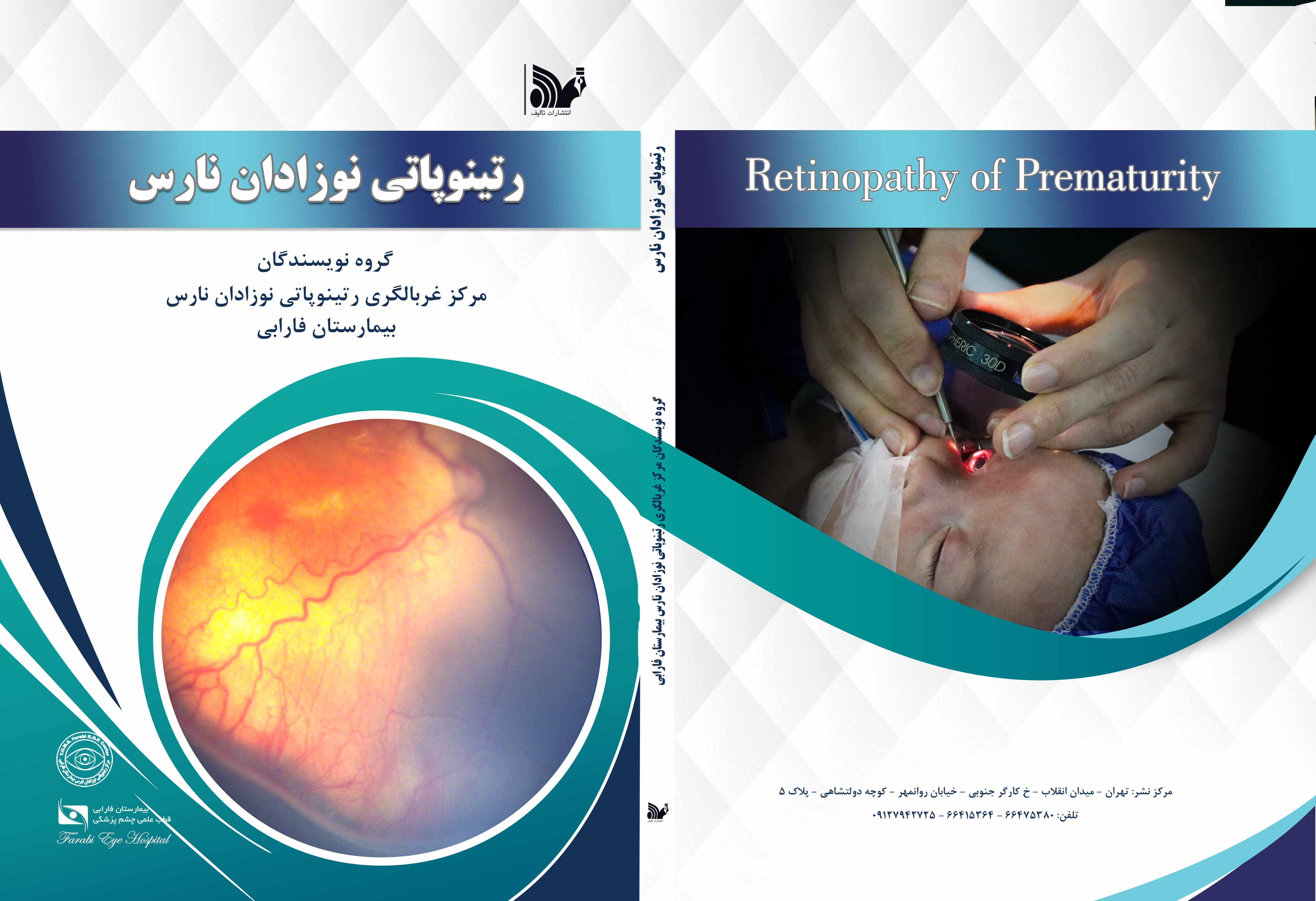 رتینوپاتی نوزادان نارس